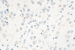 FAM76B Antibody in Immunohistochemistry (Paraffin) (IHC (P))