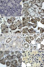Claudin 1 Antibody in Immunohistochemistry (IHC)
