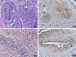 Claudin 4 Antibody in Immunohistochemistry (Paraffin) (IHC (P))