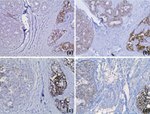 Claudin 4 Antibody in Immunohistochemistry (Paraffin) (IHC (P))