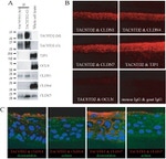 Claudin 4 Antibody in Immunohistochemistry (IHC)