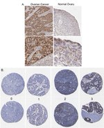 Claudin 4 Antibody in Immunohistochemistry (IHC)
