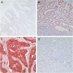 Claudin 4 Antibody in Immunohistochemistry (Paraffin) (IHC (P))