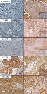 Claudin 4 Antibody in Immunohistochemistry (Paraffin) (IHC (P))