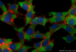 ADAM11 Antibody in Immunocytochemistry (ICC/IF)