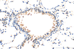 ADAM11 Antibody in Immunohistochemistry (Paraffin) (IHC (P))