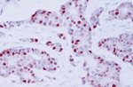 Cyclin D1 Monoclonal Antibody (AM29)