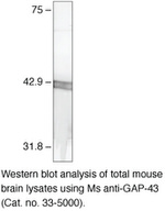 GAP43 Monoclonal Antibody (7B10)