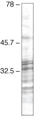 SRSF3 Monoclonal Antibody (1H4G7)