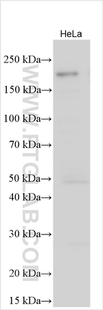 MTCL2 Antibody in Western Blot (WB)