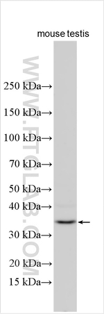 FAM166A Antibody in Western Blot (WB)
