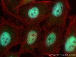 XAGE2 Antibody in Immunocytochemistry (ICC/IF)
