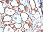 Heat Shock 27kDa Protein 1 Recombinant Rabbit Monoclonal Antibody (HSPB1, 6490R)