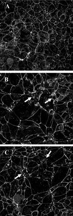Occludin Antibody in Immunocytochemistry (ICC/IF)