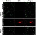 Occludin Antibody in Immunohistochemistry (Frozen) (IHC (F))
