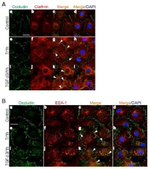 Occludin Antibody in Immunocytochemistry (ICC/IF)