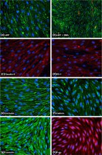 Claudin 5 Antibody in Immunocytochemistry (ICC/IF)
