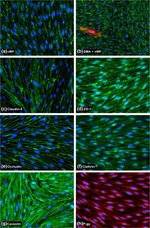Claudin 5 Antibody in Immunocytochemistry (ICC/IF)