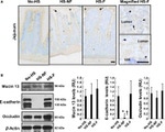 E-cadherin Antibody in Western Blot (WB)