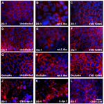 Claudin 1 Antibody in Immunocytochemistry (ICC/IF)