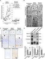 E-cadherin Antibody in Western Blot (WB)