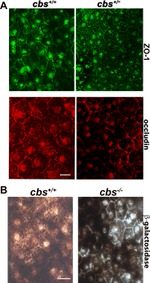 Occludin Antibody in Immunocytochemistry (ICC/IF)