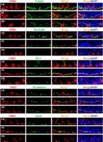N-cadherin Antibody in Immunohistochemistry (IHC)