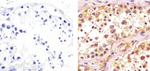 CDK1 Antibody in Immunohistochemistry (Paraffin) (IHC (P))