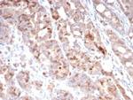 Survivin/BIRC5 Antibody in Immunohistochemistry (Paraffin) (IHC (P))