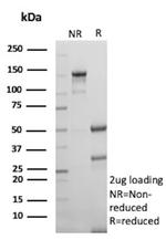 Survivin/BIRC5 Antibody in SDS-PAGE (SDS-PAGE)