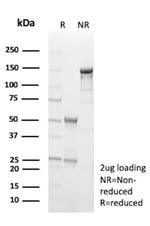 Survivin/BIRC5 Antibody in SDS-PAGE (SDS-PAGE)