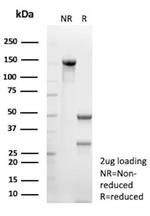Survivin/BIRC5 Antibody in SDS-PAGE (SDS-PAGE)