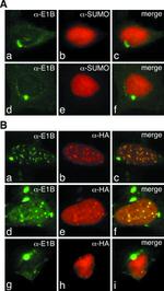 SUMO1 Antibody in Immunocytochemistry (ICC/IF)