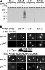 SUMO1 Antibody in Immunocytochemistry (ICC/IF)