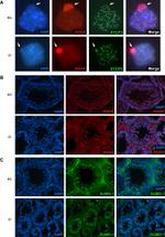 SUMO1 Antibody in Immunohistochemistry (IHC)