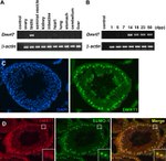 SUMO1 Antibody in Immunohistochemistry (IHC)