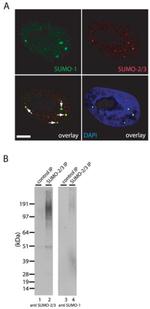 SUMO1 Antibody in Western Blot, Immunocytochemistry (WB, ICC/IF)