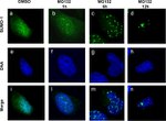 SUMO1 Antibody in Immunocytochemistry (ICC/IF)