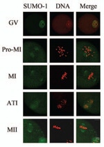 SUMO1 Antibody in Immunocytochemistry (ICC/IF)