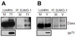 SUMO1 Antibody in Western Blot (WB)