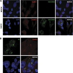 SUMO1 Antibody in Immunocytochemistry (ICC/IF)