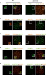 SUMO1 Antibody in Immunocytochemistry (ICC/IF)