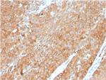 HSP90AB1 (Heat Shock Protein 90) Monoclonal Antibody (HSP90AB1/3954)