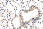 NOTCH4 Antibody in Immunohistochemistry (Paraffin) (IHC (P))