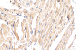 NOTCH4 Antibody in Immunohistochemistry (Paraffin) (IHC (P))