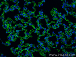 ACE Antibody in Immunohistochemistry (Paraffin) (IHC (P))