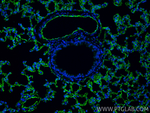 ACE Antibody in Immunohistochemistry (Paraffin) (IHC (P))