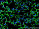 ACE Antibody in Immunohistochemistry (Paraffin) (IHC (P))