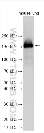 ACE Antibody in Western Blot (WB)