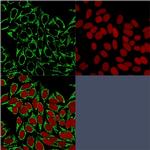 HSP60 (Heat Shock Protein 60) Monoclonal Antibody (HSPD1, 875)